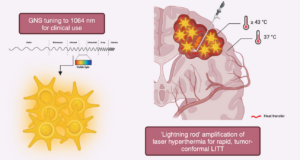 Gold nanostars amplify brain-tumor selective laser interstitial thermal therapy.
