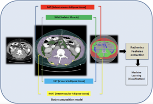 CT Radiomics and Body Composition for Predicting Hepatic Decompensation